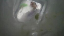 Hangover Stock Footage