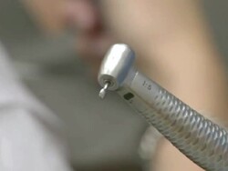 Dentist Drill Stock Footage