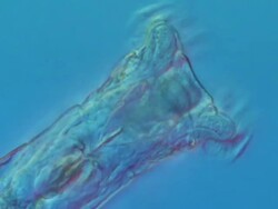 ECU Shot of Bdelloidea is class of rotifers found in fresh water and moist soil which typically have well developed corona, genus Philodina here filter feeding for bacteria and small algal cells / Newcastle Emlyn, Ceredigion, United Kingdom  Stock Footage