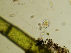 Microorganism - Vorticella Stock Footage