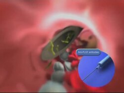 NEWS FEATURE Scientists trying to develop new treatments to fight cancer News Clip