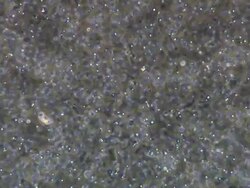 Human sperm, masses swimming around, wide pan Stock Footage