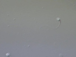 Single Human sperm swimming, Interference contrast Stock Footage