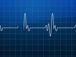 Electrocardiogram (EKG or ECG) loop Stock Footage