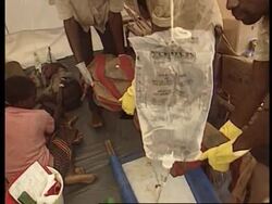 Zaire - Outbreak of cholera News Clip