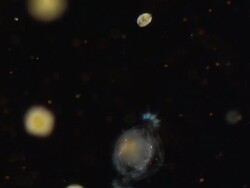 ECU SLO MO Shot of Rotifers Synchaeta pectinata / Newcastle Emlyn, Ceredigion, United Kingdom Stock Footage