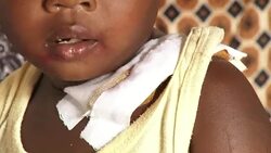 CLEAN : Young man and little girl shot during Kenya opposition protest News Clip