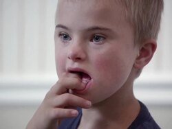 Close up of a young downs syndrome boy's face Stock Footage