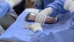 VOICED : Turquia gana viajeros por terapia capilar entre baja turistica News Clip