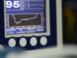 Vital signs monitor Stock Footage