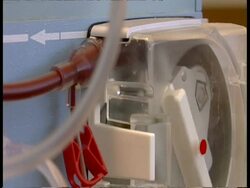 BCU Dialysis machine pumping blood Stock Footage