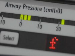 ventilator Stock Footage