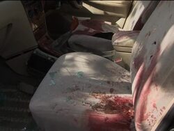 Religious Affairs Minister wounded in gun attack, driver killed News Clip