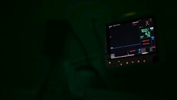 EKG monitoring patient heart rate and blood oxygen at hospital Stock Footage