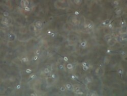 Human sperm swimming, track across, Phase contrast Stock Footage