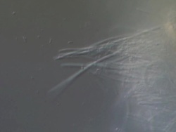 Filamentous and motile bacteria next to sloughed cell from the surface of a Human tongue. Recorded with Nomarski Differential Interference Contrast with a horizontal field of view 130 micrometres. Stock Footage