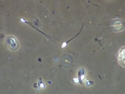 Single Human sperm swimming, best, wow shot, Phase contrast Stock Footage