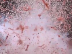 HD Super Slow-Mo: Watermelon Explosion Stock Footage