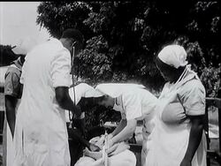 SIAMESE TWIN - THE SURVIVOR News Clip