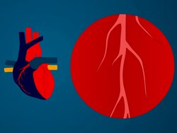 cholesterol animation Stock Footage