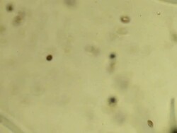 Microbes colony, film montage Stock Footage