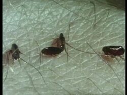 Fleas on skin and bites, sequence, archive Stock Footage