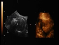 Ultrasound exam of a human baby Stock Footage