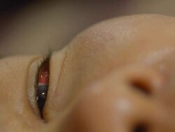 inflame eye Stock Footage