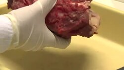 CLEAN : STOCKSHOTS: US halts Brazil beef imports after failed tests News Clip