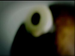 New York University arts professor Wafaa Bilal, who recently implanted a camera in the back of his head, underwent surgery on Friday after his body rejected one of the titanium posts anchoring the device to his skull. News Clip