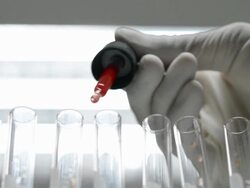 scientist testing in Blood Bank Stock Footage