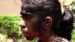 CLEAN : Bangladeshi girl seeks help for rare excess hair condition News Clip