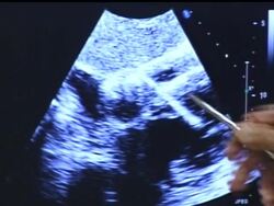 First person from doctor treating victim News Clip