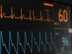 Vital signs monitor Stock Footage