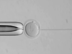 ICSI animation Stock Footage