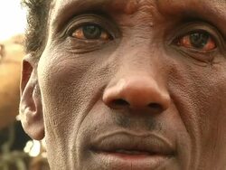 Man's face with reddened eyes Stock Footage