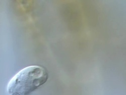ECU TS Shot of Ciliates have specialized cilia that look and function like legs allowing them to crawl along algal filaments and flick up bacteria so that they can consume them / Newcastle Emlyn, Ceredigion, United Kingdom Stock Footage