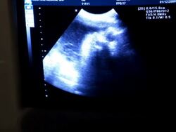 Ultrasound of full term baby Stock Footage