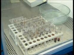 RUSSIA: RUSSIA TRIES TO RAISE AIDS AWARENESS Instructional Video