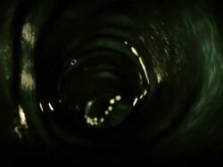 Extreme Close Up push-in push-out - A parasitic worm invasion of a human lymphatic system causes edema in a computer-generated animation. Stock Footage