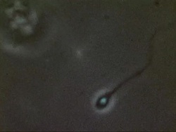 Microscopic footage of swimming sperm. Stock Footage