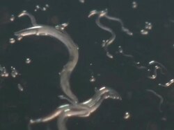 T/L Macro shot of Caenorhabditis elegans feeding on lawn of bacteria (Escherischia coli OP50) Stock Footage
