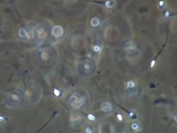 Human sperm Stock Footage