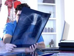 Doctors are looks at x-rays Stock Footage