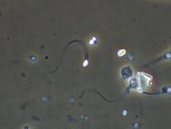 Human sperm Stock Footage