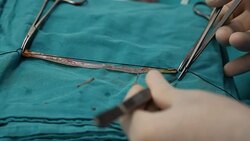 Preparing vein graft for CABG Surgery Stock Footage