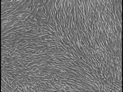 T/L Human foetal lung fibroblasts Stock Footage