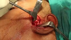 Face Joint dental option Stock Footage