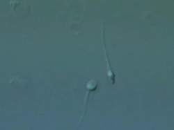 Human sperm swimming, two swim past each other, Interference contrast Stock Footage