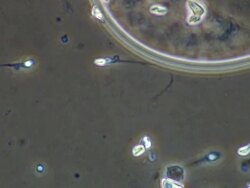 Human sperm swimming next to edge of egg-like mass Stock Footage